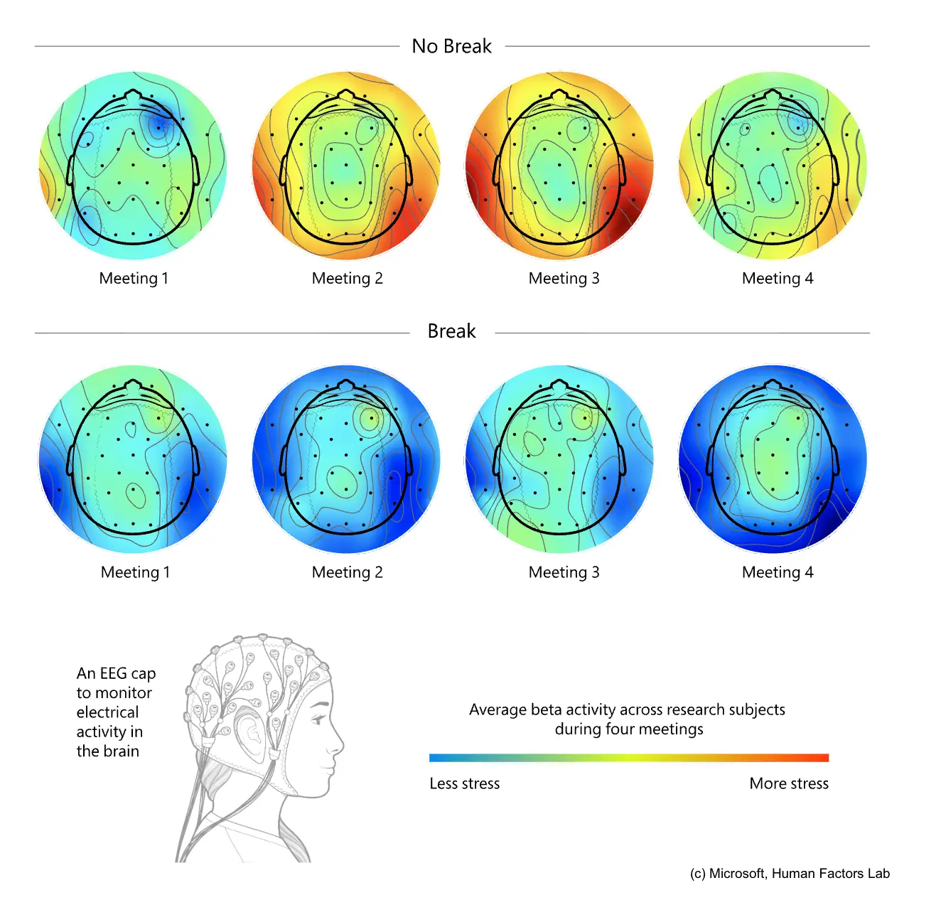 Gehirne mit und ohne Pausen
(c) Microsoft